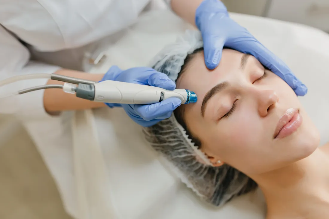 Skin treatment at SkinLab